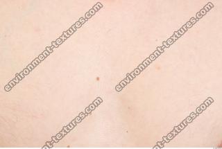 photo texture of white skin 0027